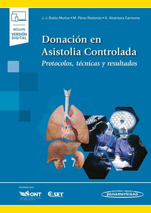 DONACIÓN EN ASISTOLIA CONTROLADA, LA (DÚO)