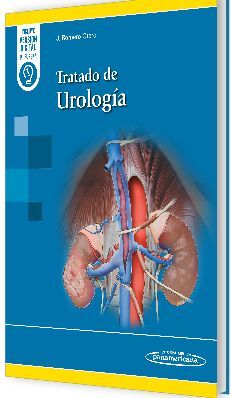 TRATADO DE UROLOGÍA (DUO)
