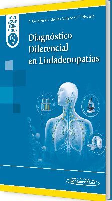 DIAGNÓSTICO DIFERENCIAL EN LINFADENOPATÍAS