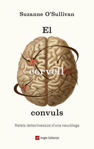 CERVELL CONVULS, EL