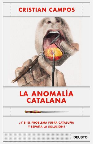 ANOMALÍA CATALANA, LA