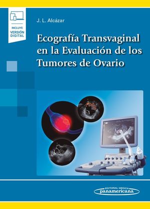 ECOGRAFÍA TRANSVAGINAL EN LA EVALUACIÓN DE LOS TUMORES DE OVARIO (INCLUYE VERSIÓN DIGITAL)