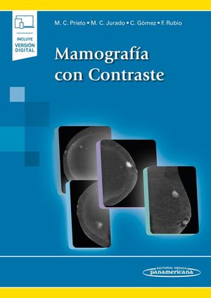 MAMOGRAFIA CON CONTRASTE (+ EBOOK)