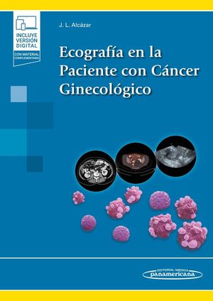 ECOGRAFÍA EN LA PACIENTE CON CÁNCER GINECOLÓGICO (VERSIÓN PAPEL + DIGITAL)